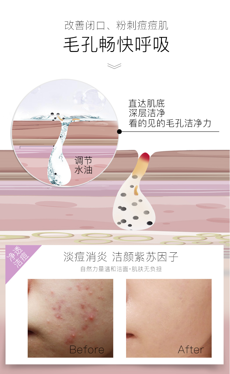 7c改善闭口粉刺(1).jpg